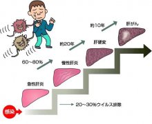 肝炎治療技術(shù),乙型肝炎治療，乙型肝炎治療技術(shù)