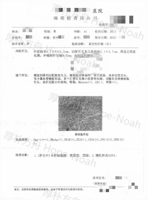 肝癌復(fù)發(fā)治療