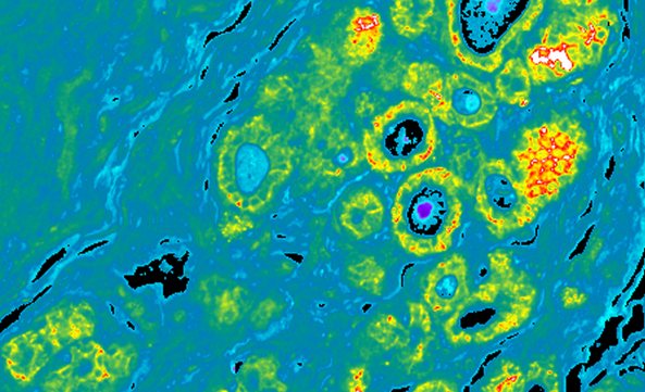 <a href='/'>出國看病</a>，<a href='/'>海外醫(yī)療</a>，厚樸方舟