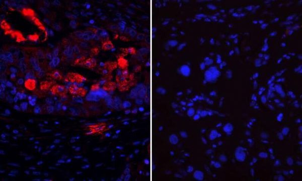 <a  data-cke-saved-href='/' href='/'>海外醫(yī)療</a>