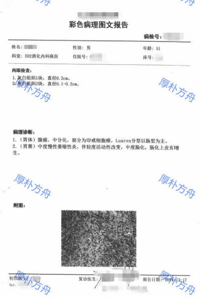 胃癌檢查報告