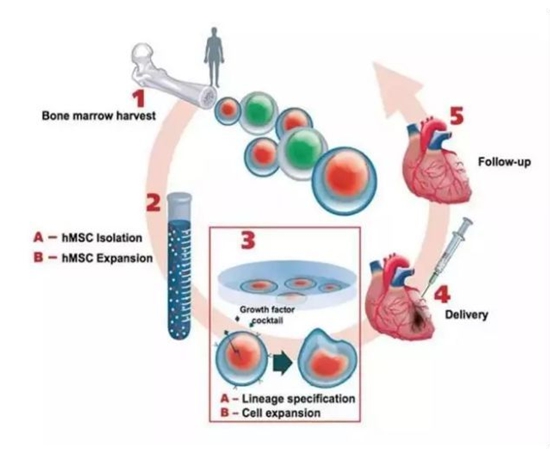 日本心臟病治療