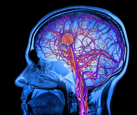 日本質(zhì)子治療