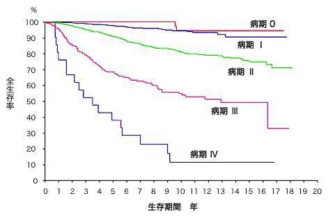 日本治療乳腺癌