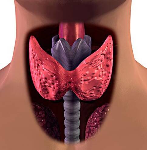 甲狀腺結(jié)節(jié),出國看病