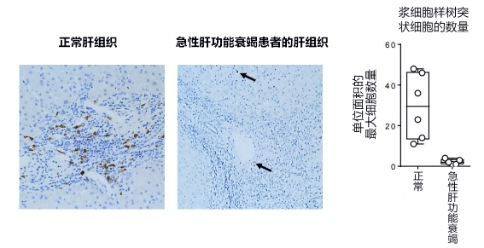 日本發(fā)現(xiàn)控制急性肝衰竭的新型免疫細胞，有望開發(fā)新治療方法