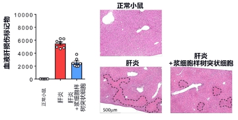 日本發(fā)現(xiàn)控制急性肝衰竭的新型免疫細胞，有望開發(fā)新治療方法