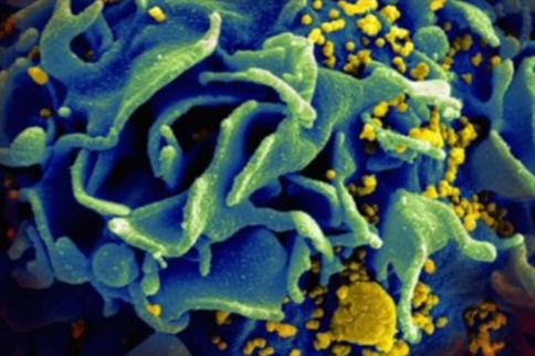 duoCAR-T細胞可有效抵抗HIV