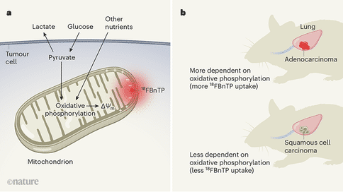 新研究闡明了腫瘤中代謝的脆弱性，或對于肺癌治療具有重要作用