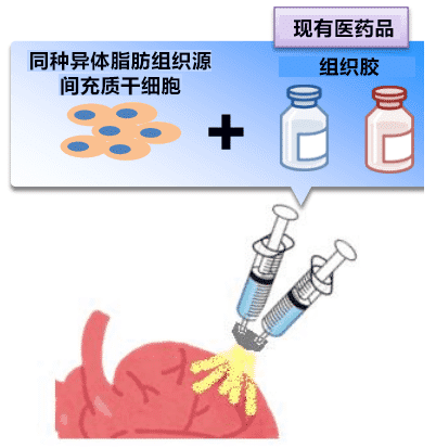 日本開發(fā)出一種治療心力衰竭的新技能，目前已進行臨床試驗！