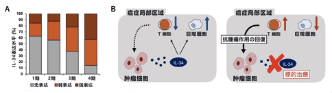 日本新研究指出IL-34與卵巢癌的進(jìn)展和復(fù)發(fā)有密切聯(lián)系！