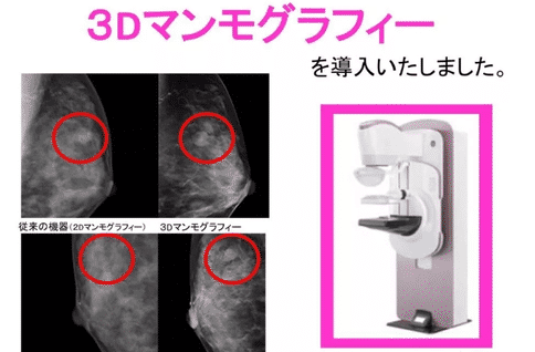 重離子治療