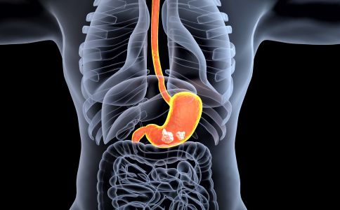 日本胃癌五年生存率 日本胃癌五年生存率