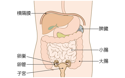 日本卵巢癌治療方法 日本卵巢癌治療方法