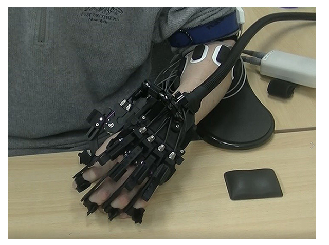 日本治療腦梗 日本治療腦梗