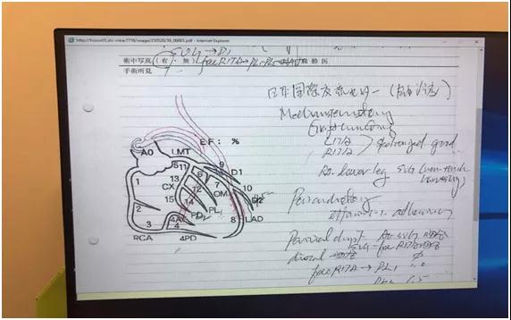 日本治療冠心病