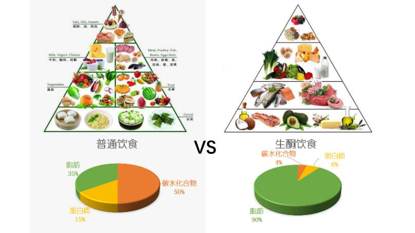 日本治療癲癇 日本治療癲癇