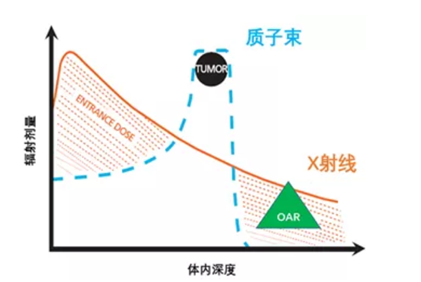 質子治療鼻咽癌