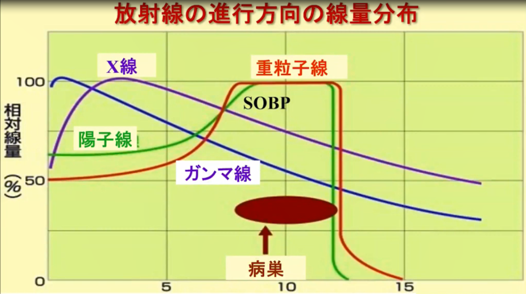 日本重離子治療