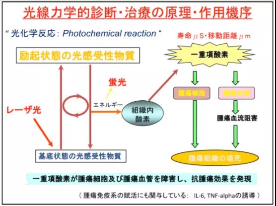 光動力治療肺癌等癌癥