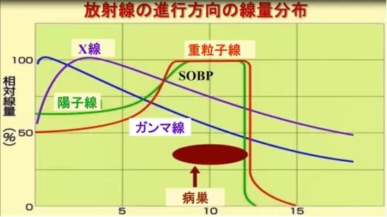 質(zhì)子重離子治療的優(yōu)勢