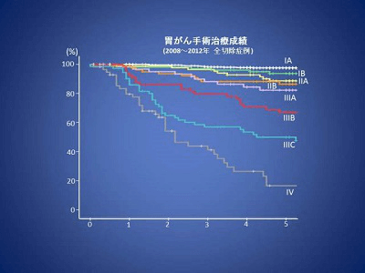 日本胃癌治療權(quán)威醫(yī)院