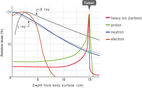 日本重離子治療腫瘤