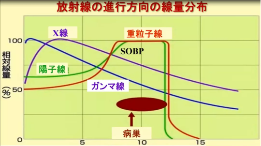 日本筑波大學(xué)附屬醫(yī)院質(zhì)子治療